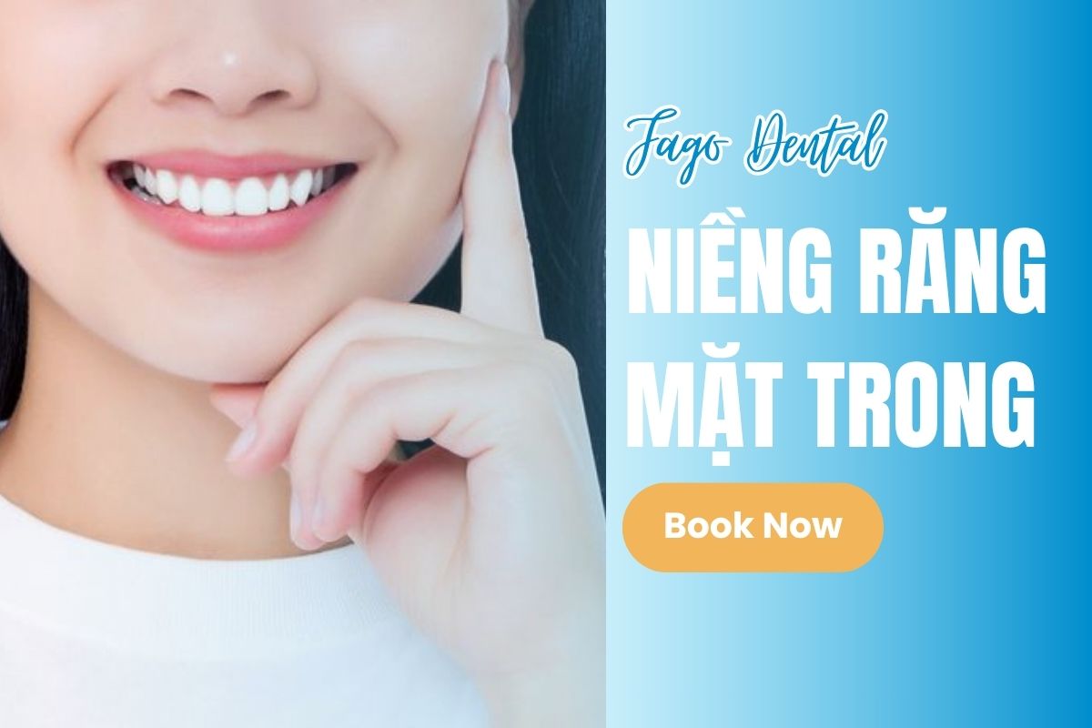 Niềng Răng Mặt Trong
