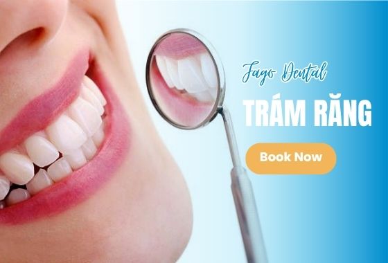 Trám Răng