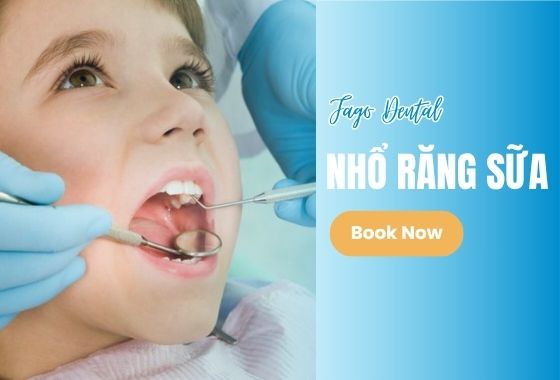 Nhổ Răng Sữa Trẻ Em